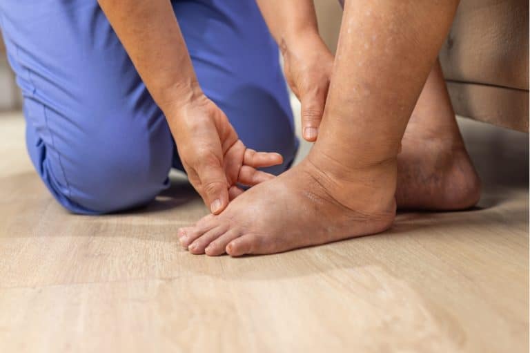A nurse examines a woman's foot that has suspected lymphedema
